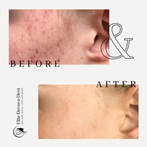 Skin Transformations 2