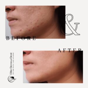 Skin Transformations 3