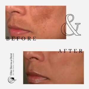 Skin Transformations 4