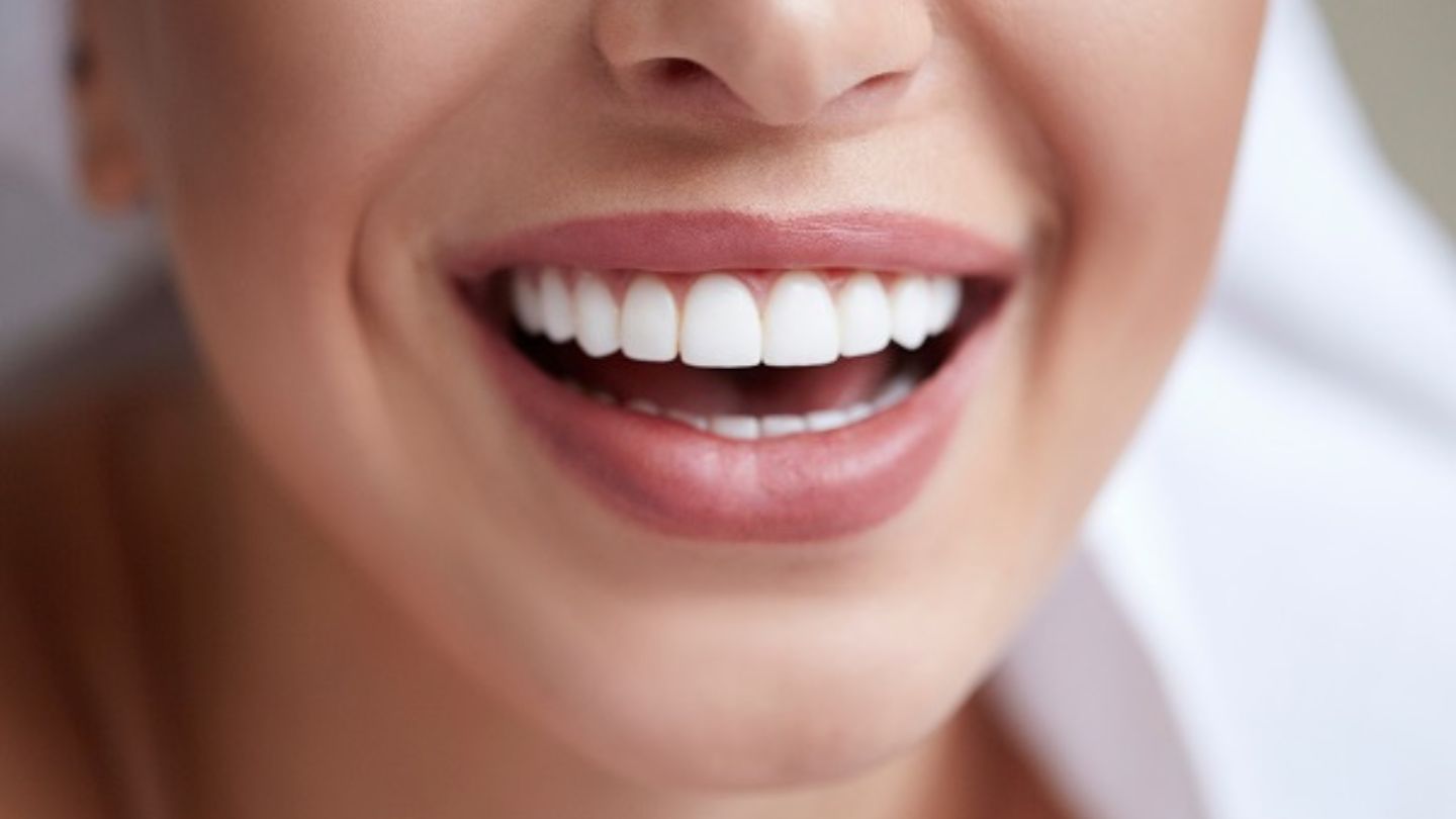 Dental Laminates in Thane: Smile Brighter Than Ever! 1 Dental Laminates in Thane