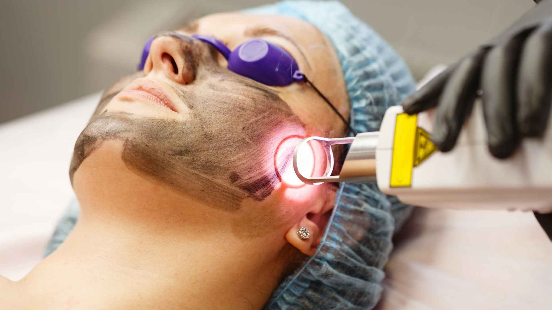 Q Switch Laser in Thane