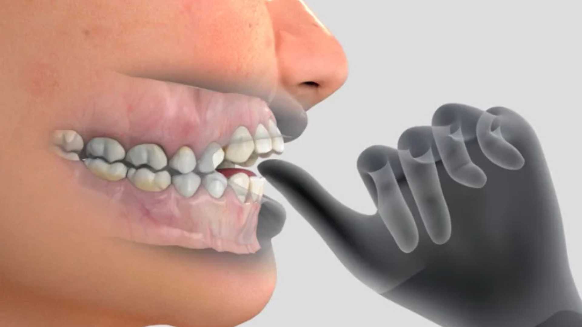 Dental Habit Breakers