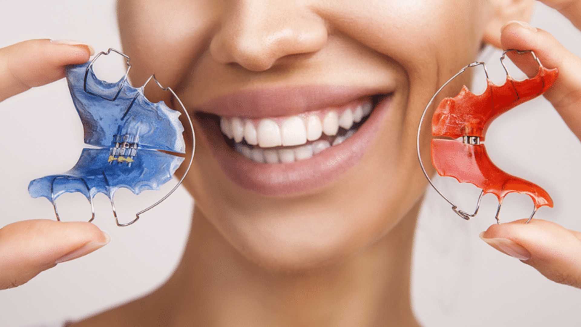 Dental Retainers