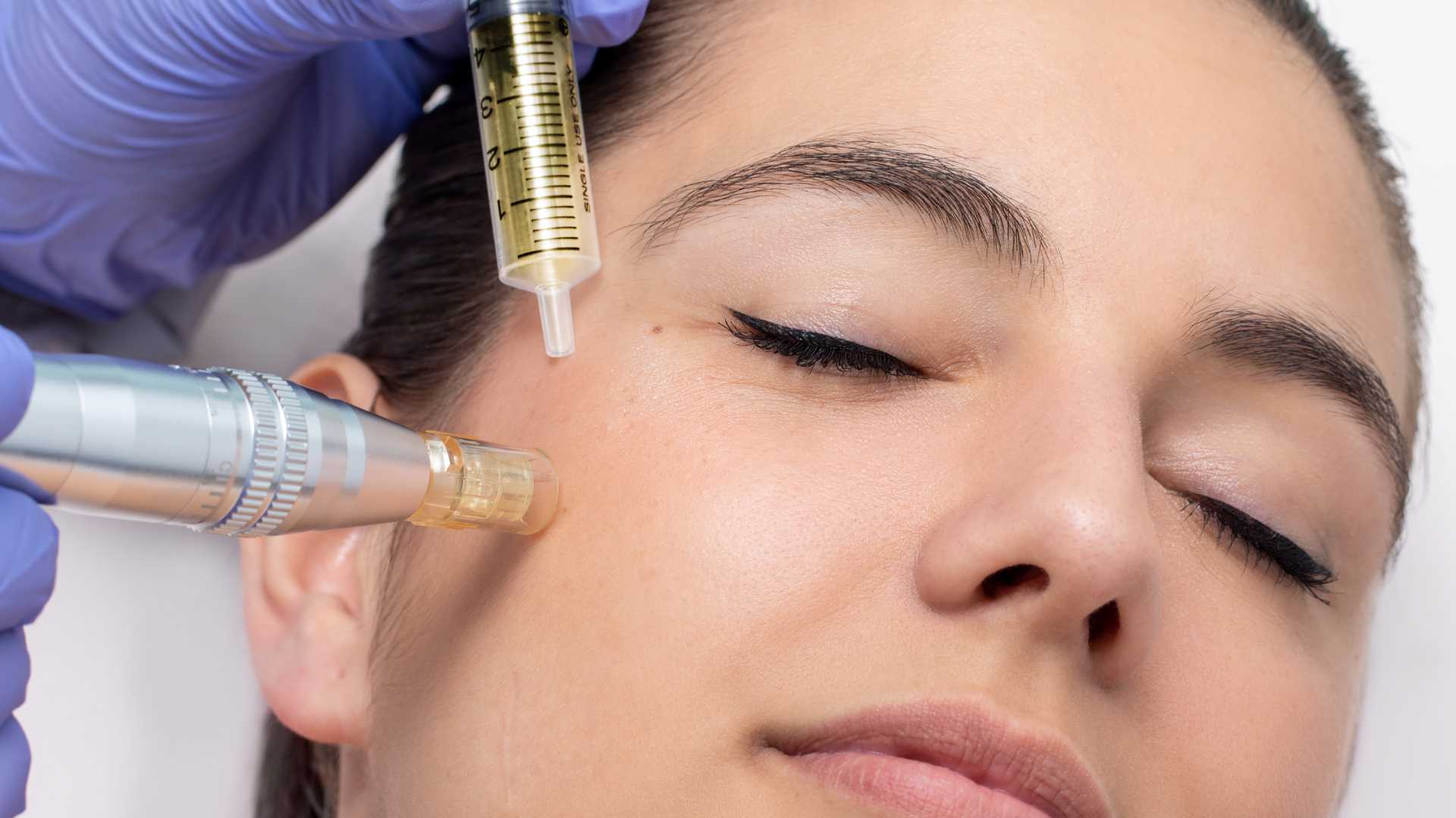 Dermapen Treatment
