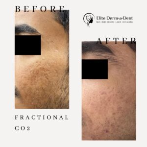 EDD Before After Format Skin Care 1
