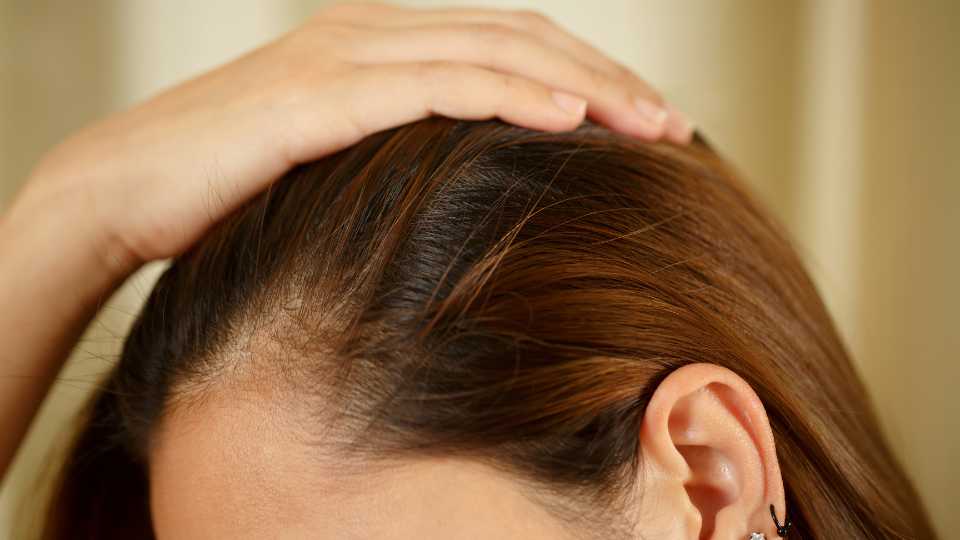 Hair IV in Thane | Dr. Arefa Patel | Elite Dermadent 1 Hair IV in Thane (1)