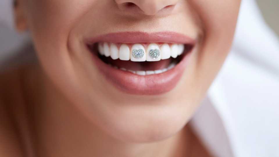 Tooth Jewelry in Thane | Dr. Saurabh Pakhale | Elite Dermadent 1 Tooth Jewelry in Thane