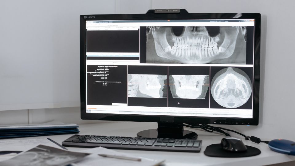 Dental X-Ray in Thane