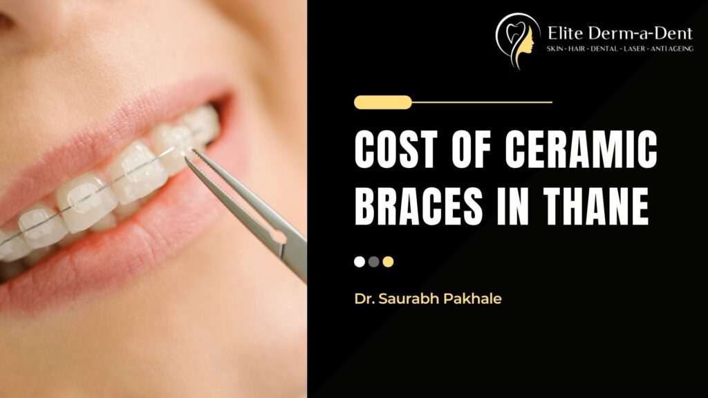 cost of ceramic braces in thane