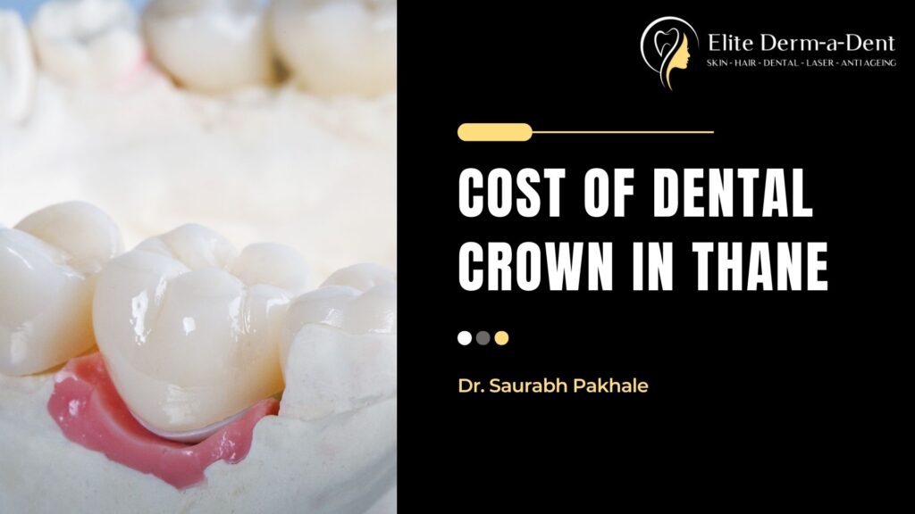 cost of dental crown in thane