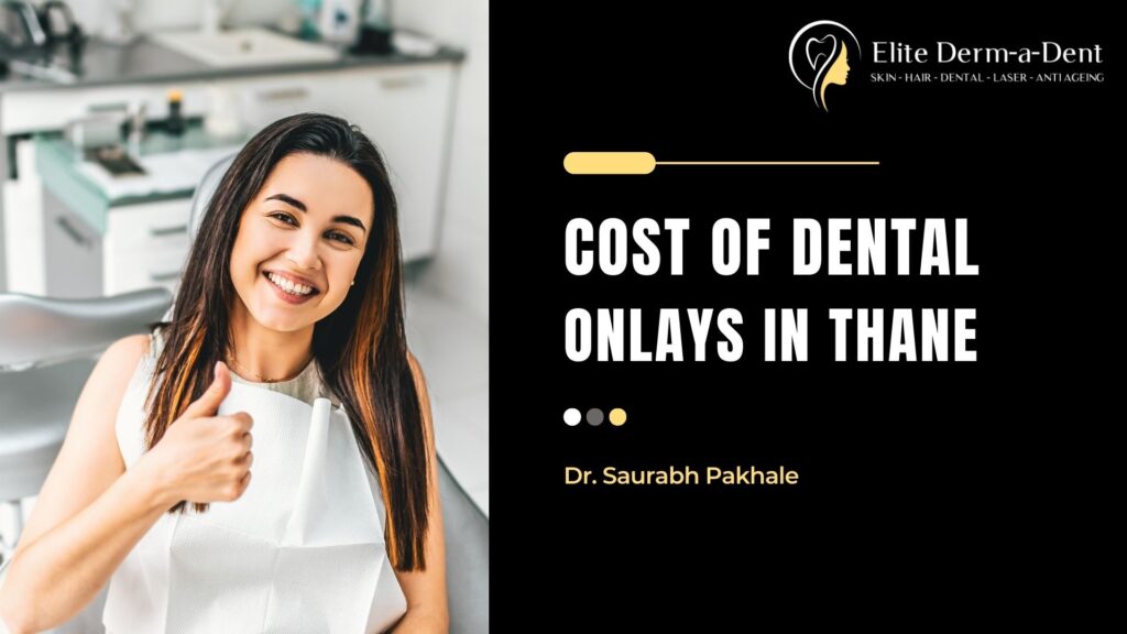 cost of dental onlays in thane