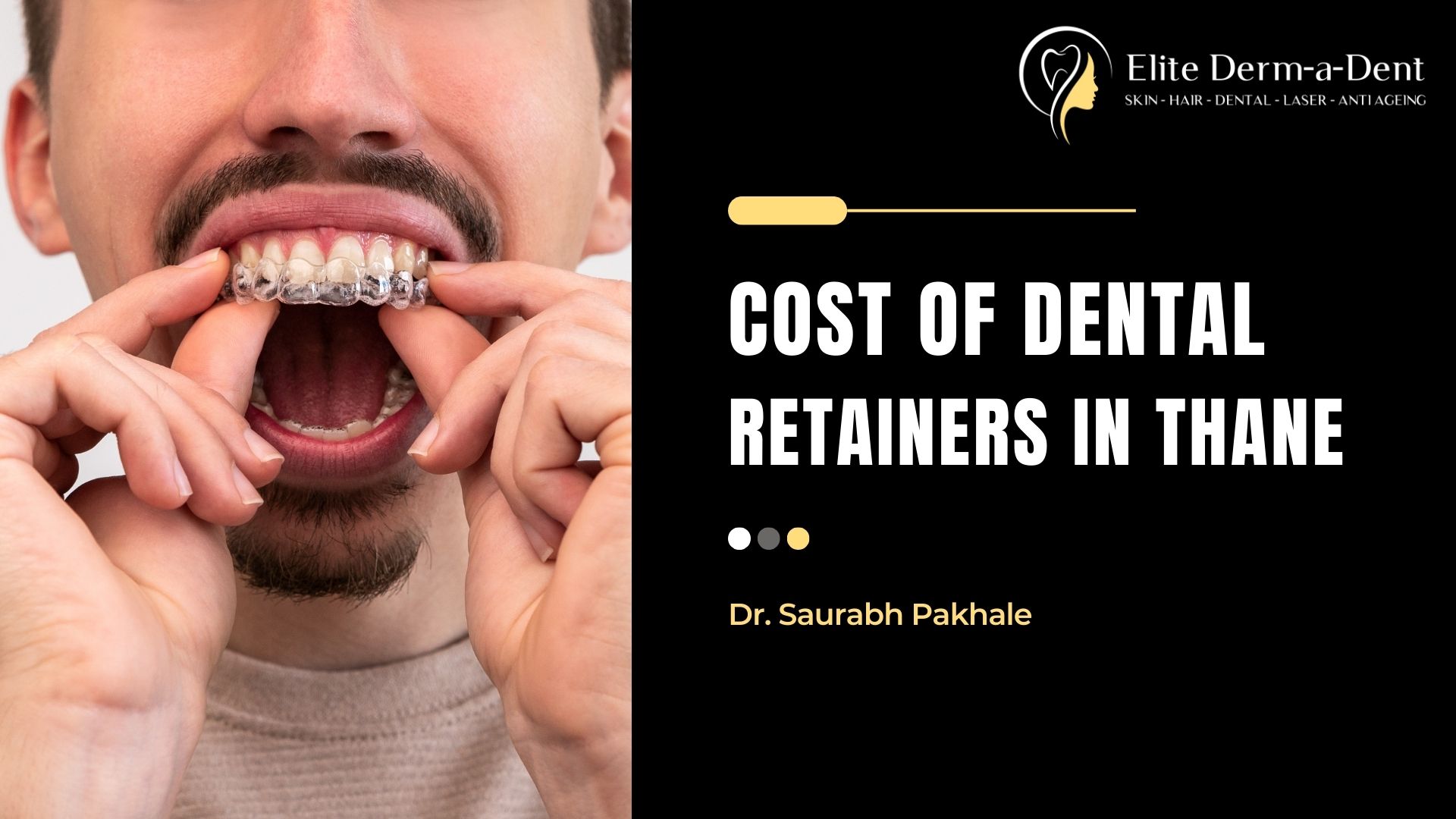 cost of dental retainers in thane