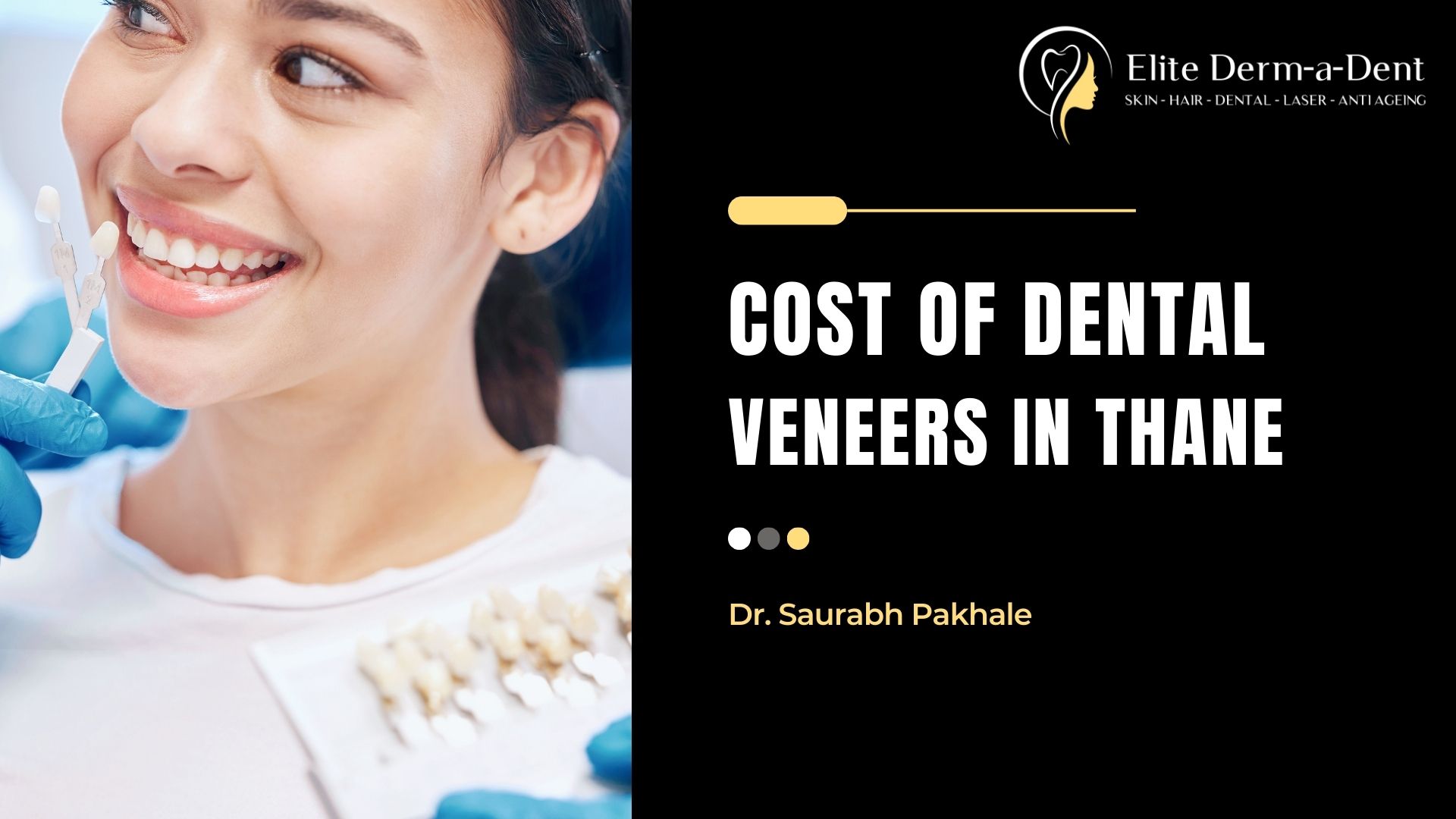 cost of dental veneers in thane